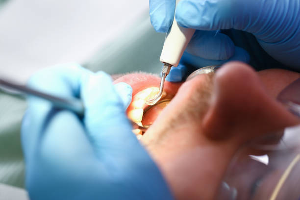 Best Emergency TMJ Treatment in Barnesville, MN
