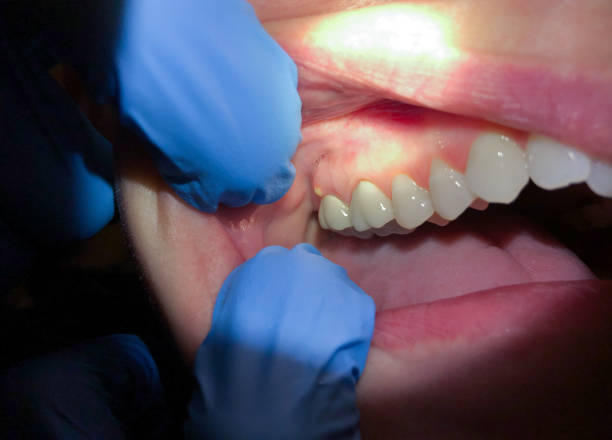 Best Emergency Root Canal Treatment in Barnesville, MN