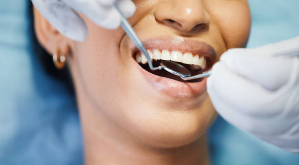 Best Emergency Wisdom Teeth Removal in Barnesville, MN