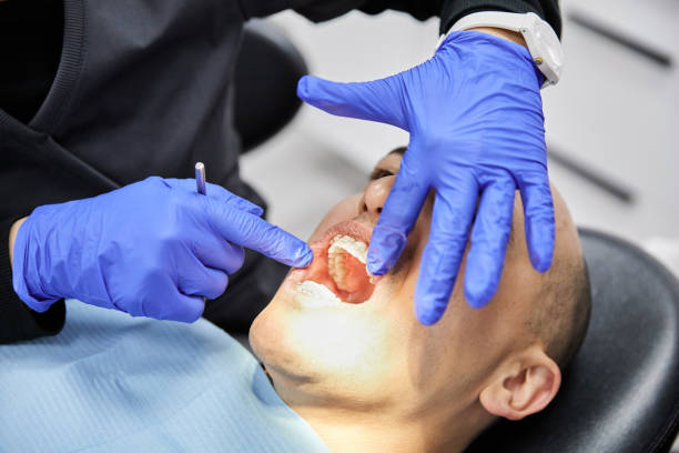Best Emergency Treatment for Dental Infections or Abscesses in Barnesville, MN
